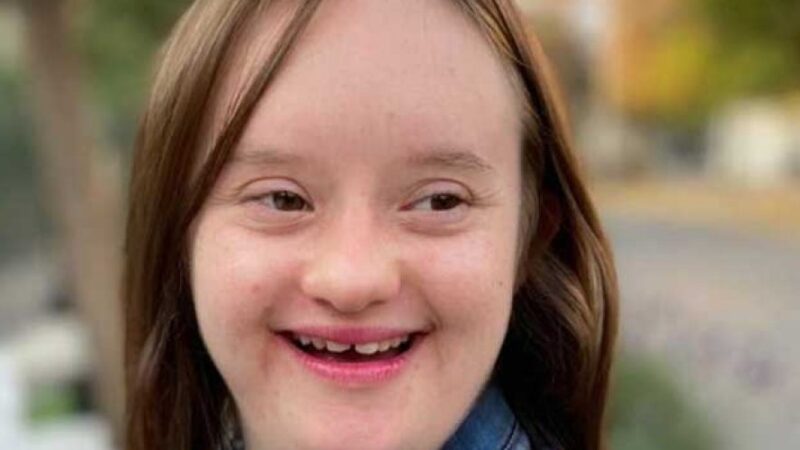 Mujer con sindrome de down