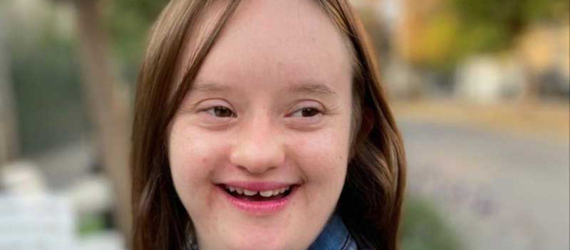 Mujer con sindrome de down