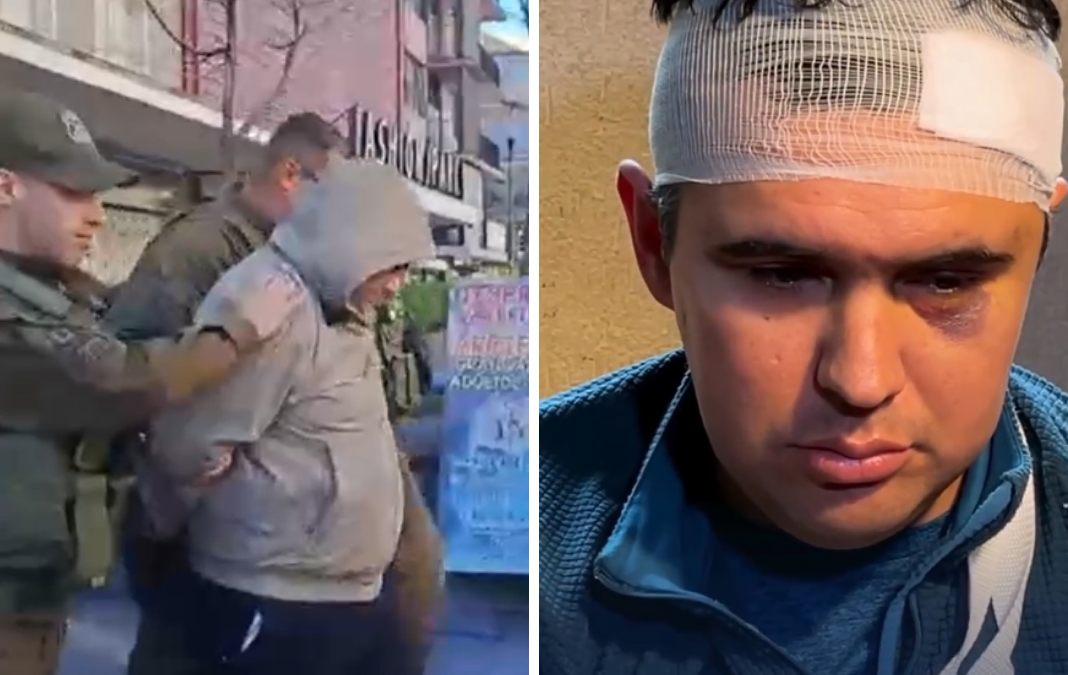 Imagen dividida en dos: lado izquierdo hombre siendo detenido por carabineros. Lado derecho un hombre con diversas lesiones en su rostro
