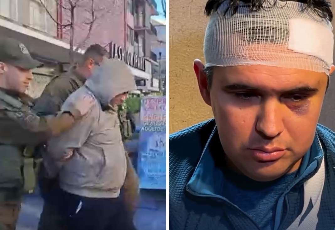 Imagen dividida en dos: lado izquierdo hombre siendo detenido por carabineros. Lado derecho un hombre con diversas lesiones en su rostro