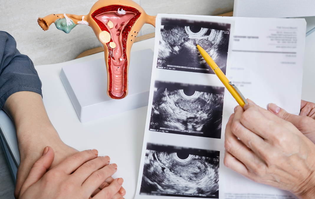 Imagen de médico mostrando ecografía a mujer