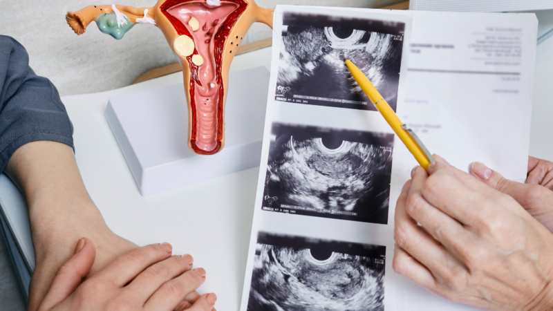 Imagen de médico mostrando ecografía a mujer