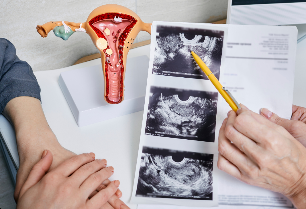 Imagen de médico mostrando ecografía a mujer