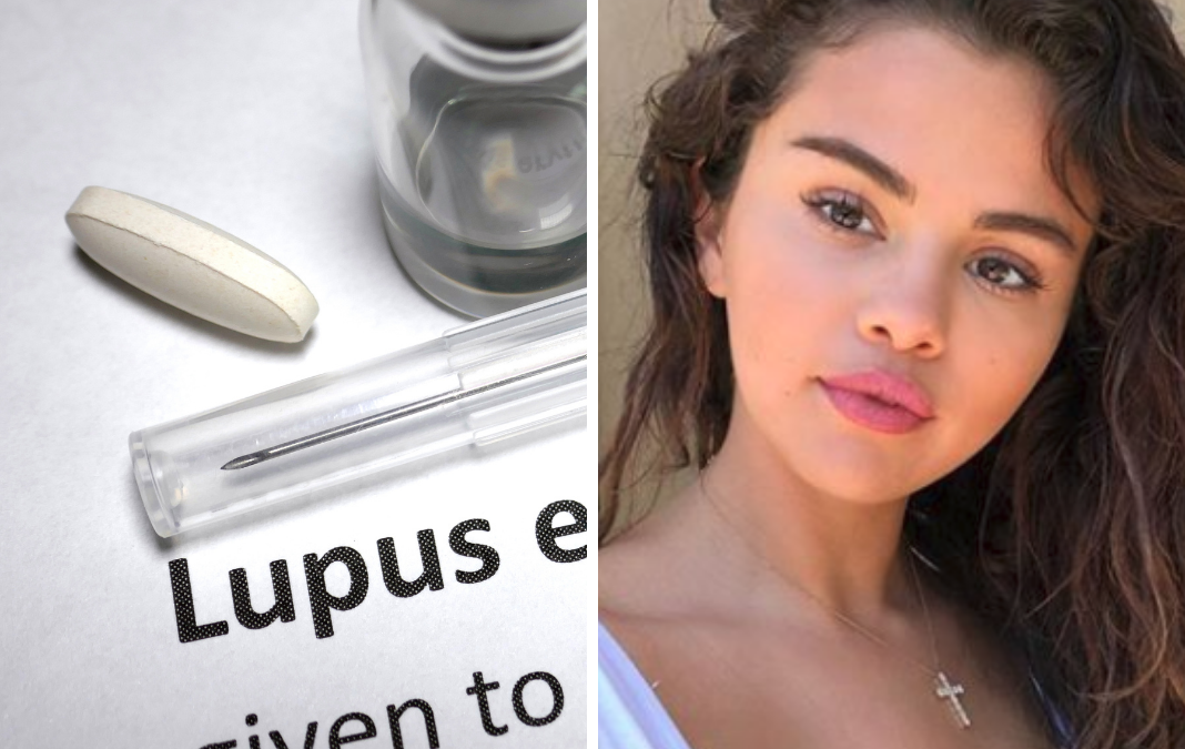 Imagen que dice lupus y al lado una imagen de Selena Gómez