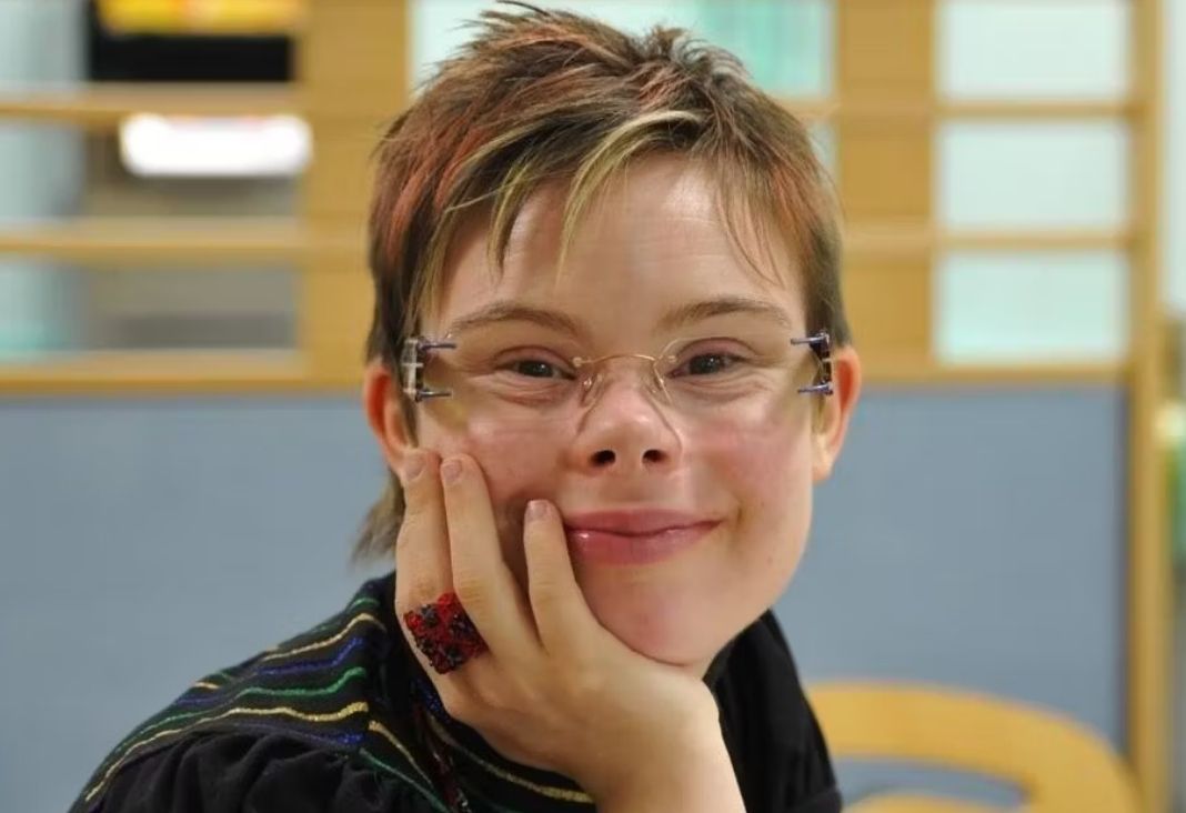 Mujer con síndrome de Down sonriendo a la cámara